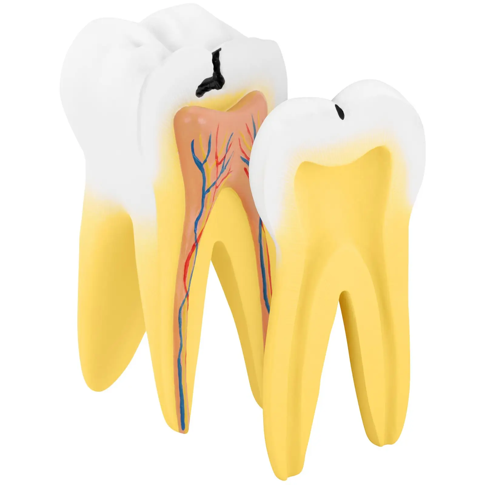 Ząb trzonowy - model anatomiczny